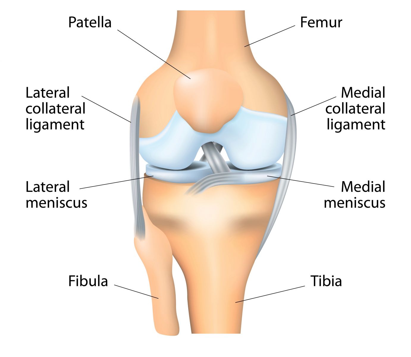 La rotule, l'Achille de la prothèse totale de genou